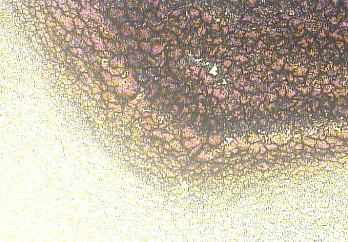 Pleomorphic Sample