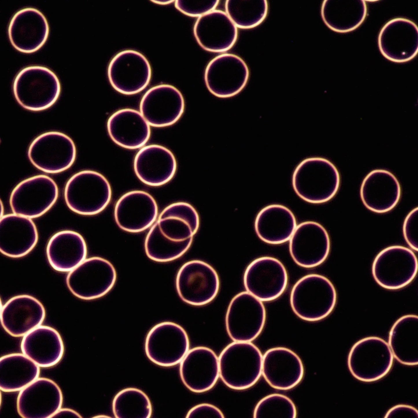 Pleomorphic Sample